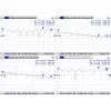 Kabelis Mmcx uz RPSMA/ACMMCXRPSMA Mikrotik
