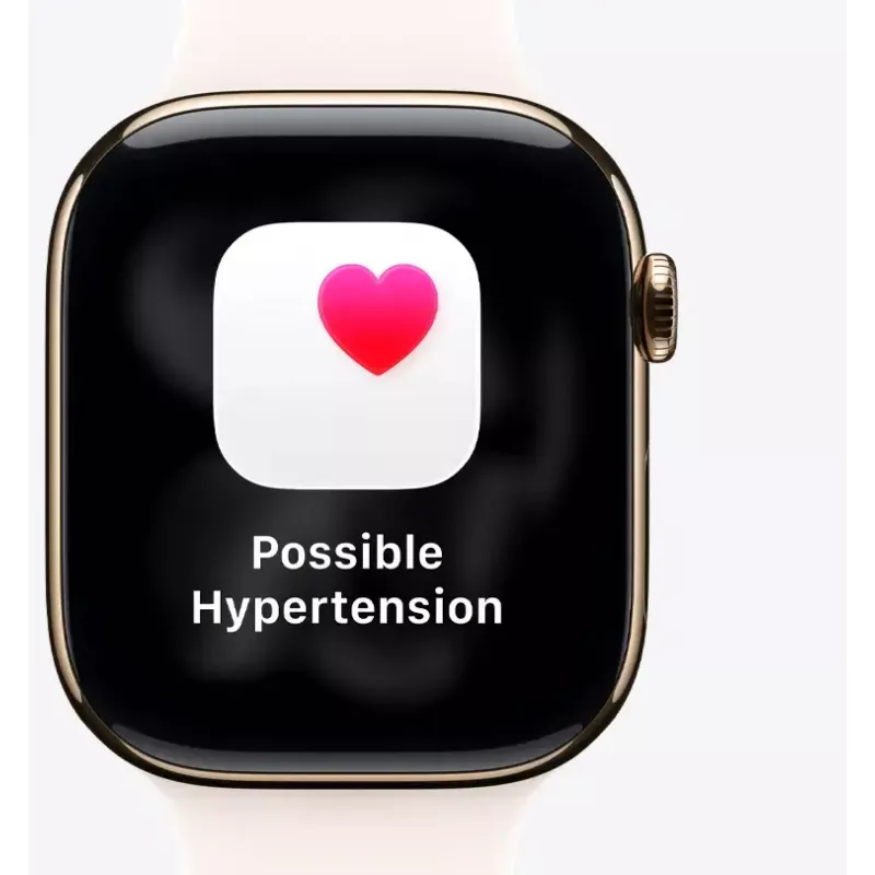 Viedpulkstenis Apple Watch Ultra 3 GPS + Cellular 49mm Melns Titāna Korpuss ar Melnu Alpine Loop Vidēju