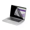 StarTech.com 16 collu MacBook Pro 21/23 klēpjdatora privātuma ekrāns, noņemams un atgriezenisks pretatspīduma privātuma filtrs, magnētisks klēpjdatora ekrāna aizsargs ar 51% zilās gaismas samazinājumu