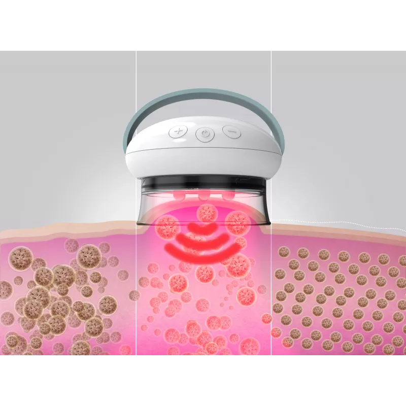 HoMedics Smoothee IR masieris Kājām Balts 4 galvas Darbojas ar baterijām