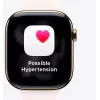 Viedpulkstenis Apple Watch Series 11 GPS + Cellular 46mm titāna korpuss