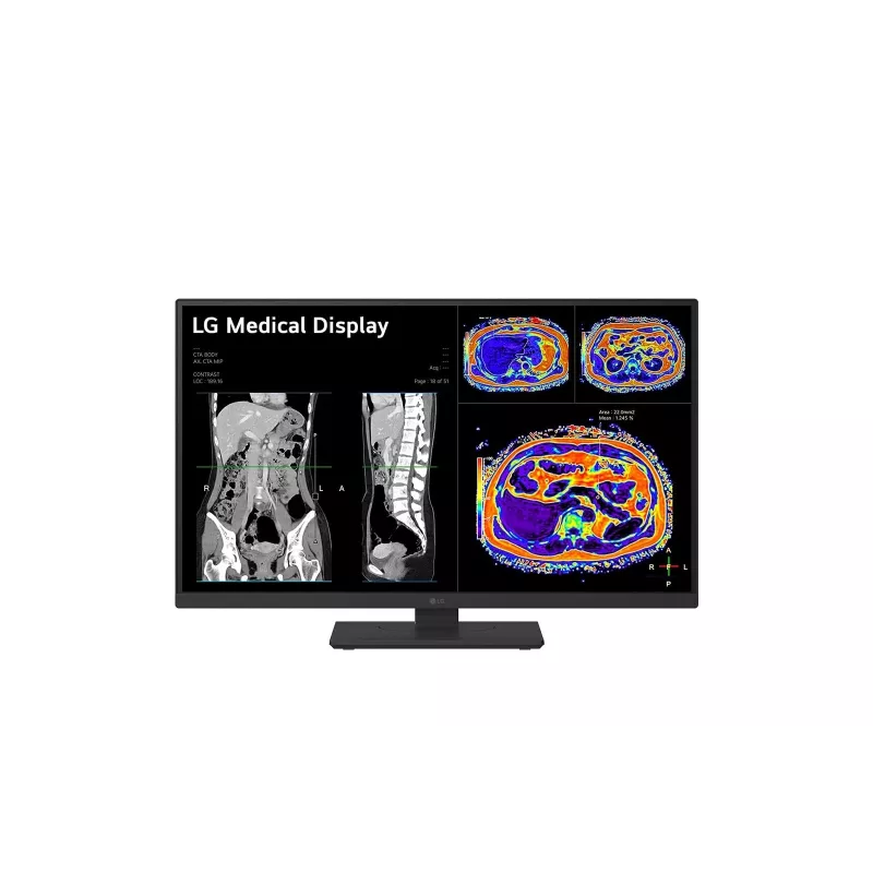 LG 27HS713C-B datora monitors 68,6 cm (27 collas) 3840 x 2160 pikseļi 4K Ultra HD LED melns