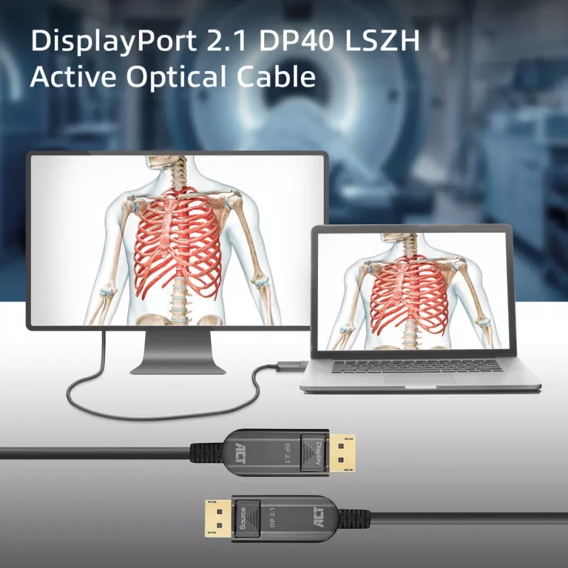 ACT AK4171 DisplayPort kabelis 15 m Melns