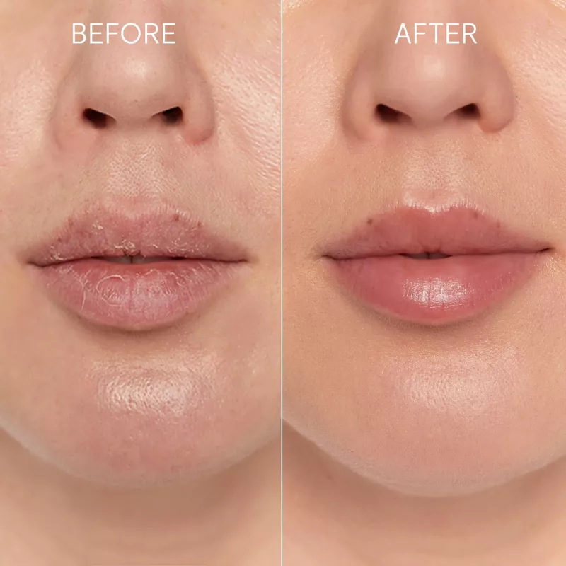 GLOV Scrubex Lip Exfoliating Mitt - 2 Pack | Maigs mikrošķiedras lūpu skrubis gludām lūpām