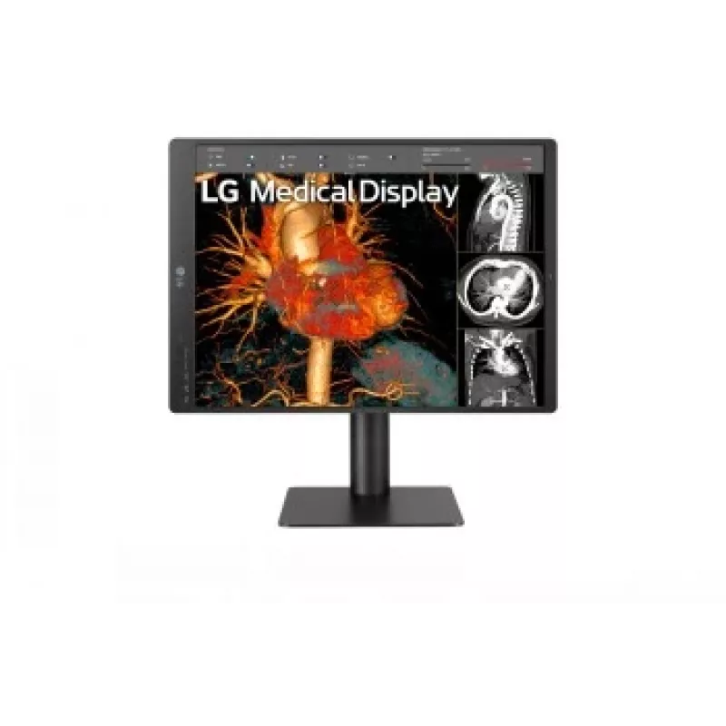LG 21.3 inch 3MP IPS diagnostiskais monitors 21HQ513D-M
