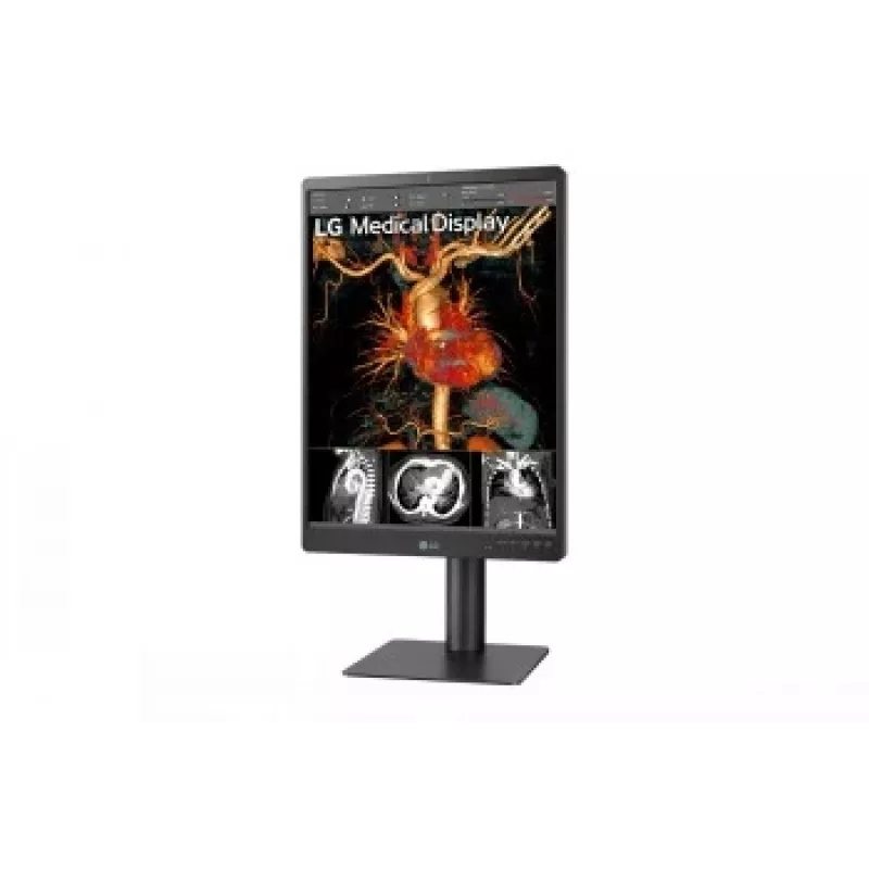 LG 21.3 inch 3MP IPS diagnostiskais monitors 21HQ513D-M