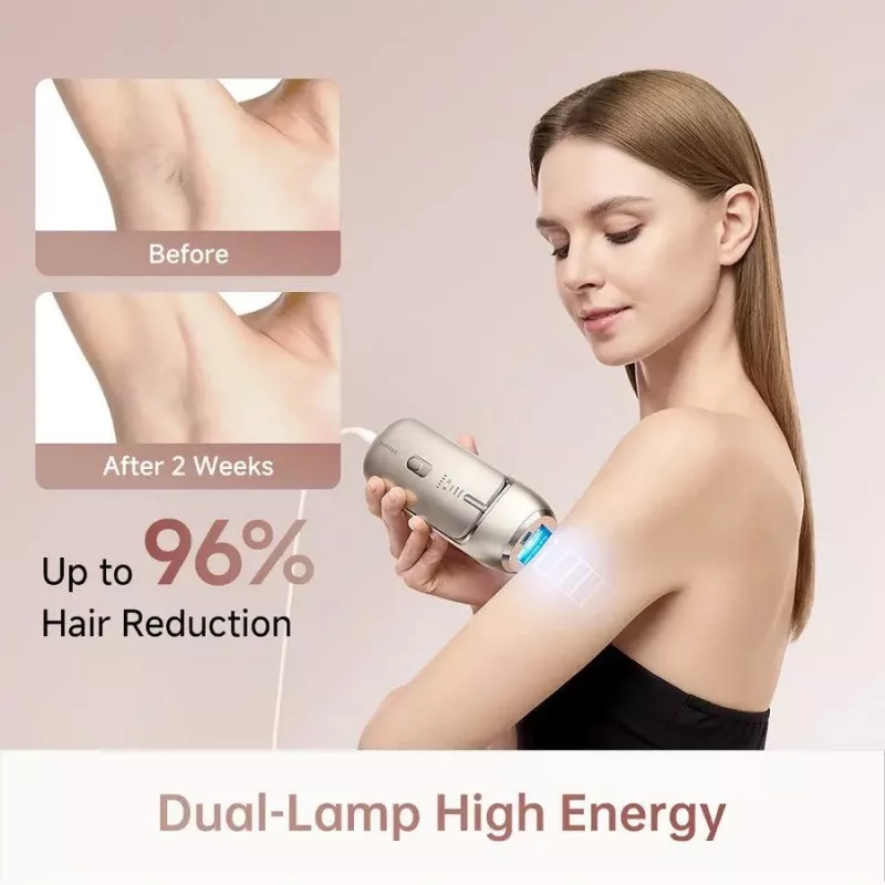 Dreame AHR01-GOLD IPL matu noņemšanas ierīce Nova Gold ar 990 000 zibšņiem, 5 enerģijas līmeņiem, UV filtru, ar vadu